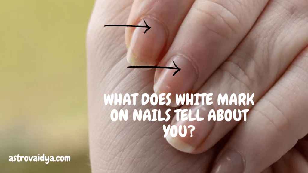 WHAT DOES WHITE MARK ON NAILS TELL ABOUT YOU?