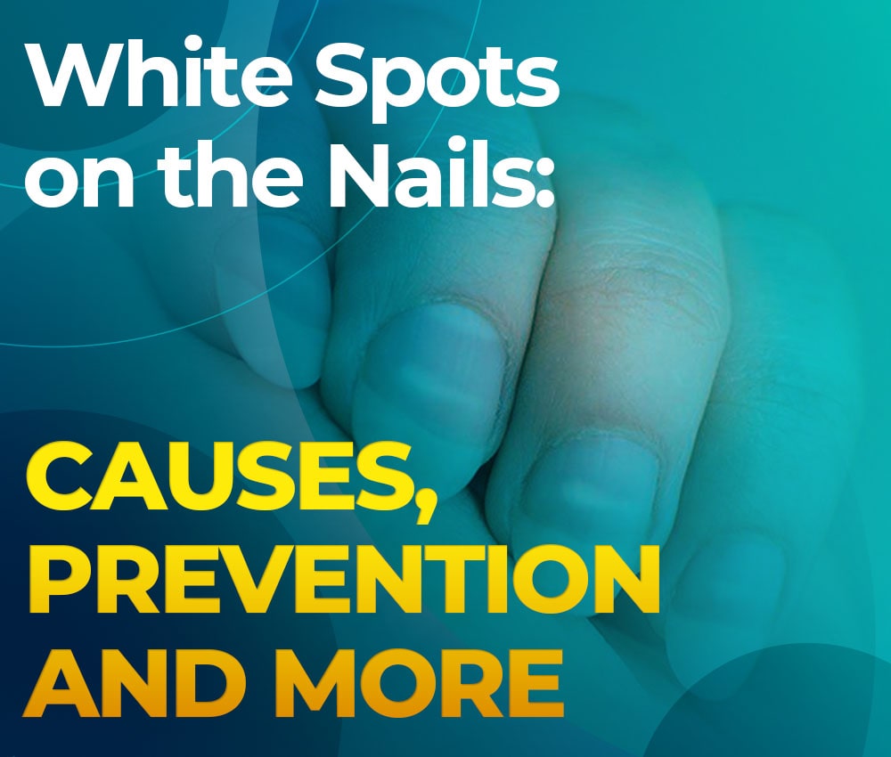 How to Prevent White Spots on the Nails