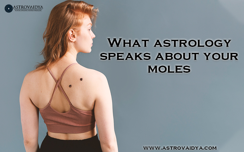 What astrology speaks about your moles IMG